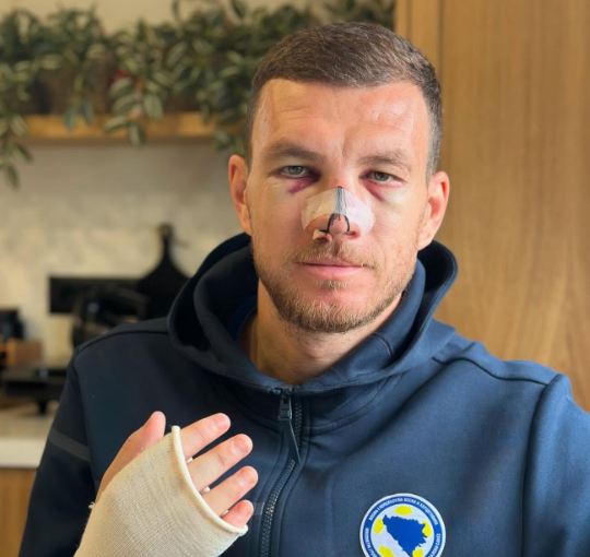Instagram: duro scontro per Dzeko con la Bosnia, l’ex Roma pubblica lo scatto. Nainggolan risponde: “Stai benissimo” (FOTO)